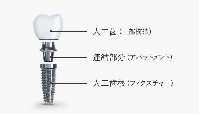 体に優しいチタン素材